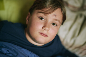 Little boy with macro sutures on forehead, kid resting in bed