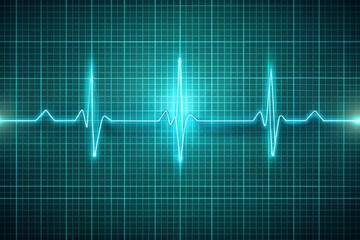 High-quality digital art of an electrocardiogram strip displaying right axis deviation with precise and vivid amplitude and interval measurements on a subtle grid background
