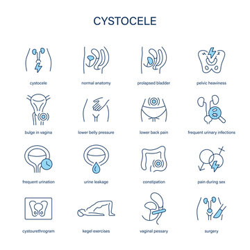 Cystocele symptoms, diagnostic and treatment vector icons. Medical icons.