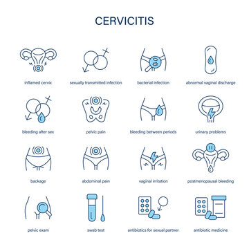 Cervicitis symptoms, diagnostic and treatment vector icons. Medical icons.