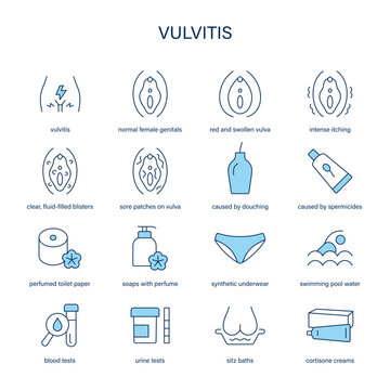 Vulvitis symptoms, diagnostic and treatment vector icons. Medical icons.