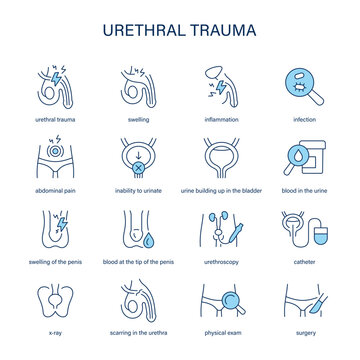 Urethral Trauma symptoms, diagnostic and treatment vector icons. Medical icons.