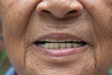 An old Asian woman is smiling with only her mouth.