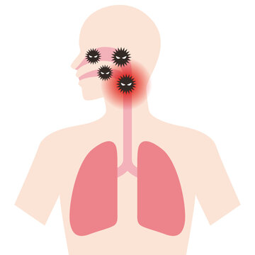 recommend clip art: のどに感染