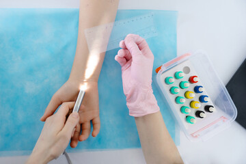 Doctor doing skin allergy test at white table in office. Immunology doctor is measuring allergy reaction of patient