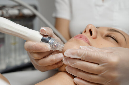 Hands of dermatologist proceeding microdermabrasion treatment on woman