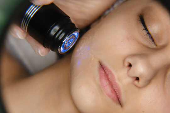 Hand of dermatologist doing Rf lifting procedure on woman's face