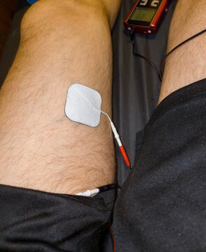 Electrotherapy with self-adhesive electrodes on a leg to relieve muscle pain