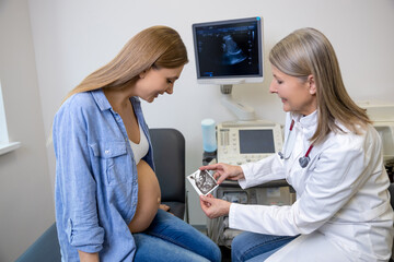 Pregnant woman holding a picture from ultrasonography