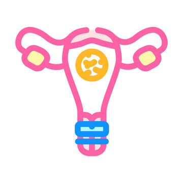 cervical cerclage surgery color icon vector. cervical cerclage surgery sign. isolated symbol illustration