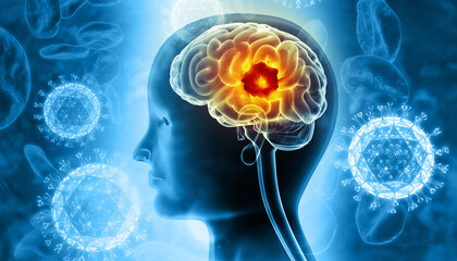Visual concept of brain tumor or barin cancer. 3d illustration