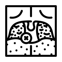 tonsillectomy surgery line icon vector. tonsillectomy surgery sign. isolated contour symbol black illustration