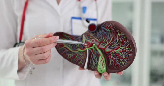Doctor examines liver model focusing on diseases