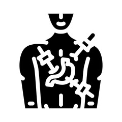 laparoscopy surgery glyph icon vector. laparoscopy surgery sign. isolated symbol illustration