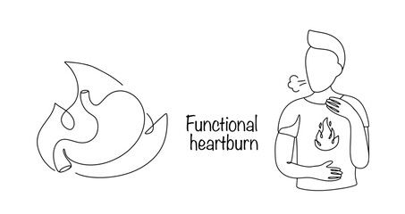 Functional heartburn