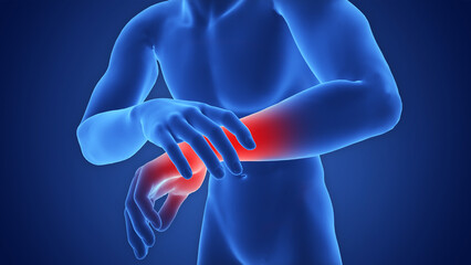 Human Suffering with Severe Pain in Wrist Joint Anatomy
