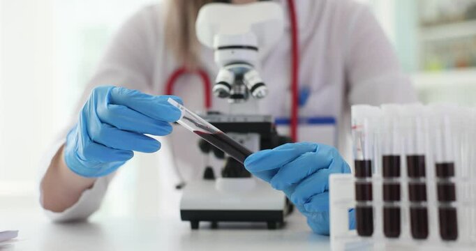 Health care worker analyzes blood sample in a laboratory using a microscope
