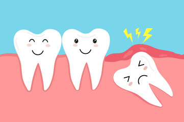 Impacted wisdom tooth. Crooked teeth. Toothache molar. inflamed and swollen gum. Dental care. Vector illustration