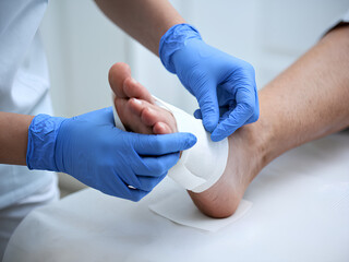 A nurse wearing blue gloves doing bandage on a wound on a person's foot - Powered by Adobe