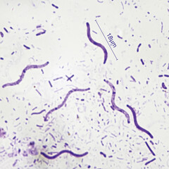 Fototapeta premium Rhodospirillum Crimson red spirochetes is a spiral shaped bacterium that is Gram negative and generally undergoes anaerobic phototrophic living.Magnify 1000x 