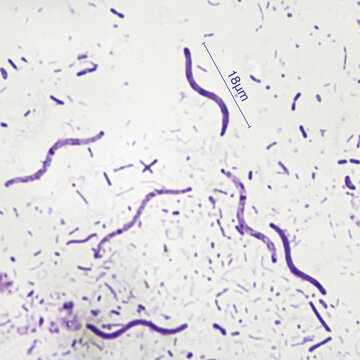 Rhodospirillum Crimson red spirochetes is a spiral shaped bacterium that is Gram negative and generally undergoes anaerobic phototrophic living.Magnify 1000x
