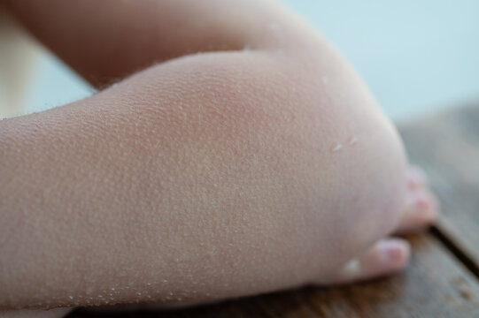 close up of a kids arm with goosebumps