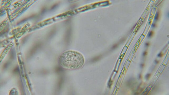 Research Scientists Unicellular Organisms. Soil Microorganisms Under Microscope Including Amoeba, Flagellates, Nematodes, Fungi, Bacteria From Healthy Soil. Bacterias for Carbon Sequestration.