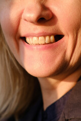 Mature woman is showing smiling mouth without tooth on upper jaw. Missing tooth. Waiting an implant after tooth extraction. © leroy