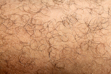 The skin texture of an Asian man's legs is brown in color with hair on his legs