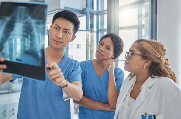 Results, xray and doctors with surgeon for teamwork, research and analysis for solution in...