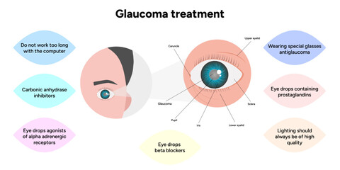 Glaucoma treatment medical information and anatomy ophthalmologist
