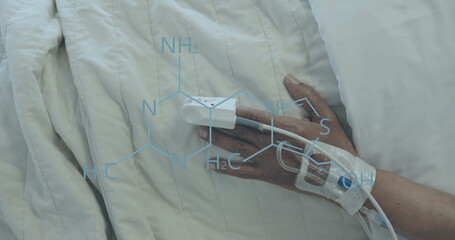Image of element diagram over african american female patient hand with drip and oximeter