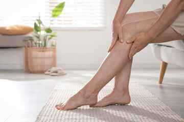 Woman suffering from varicose veins on sofa indoors, closeup. Space for text