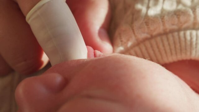 Close-up of infant tongue tie being examined. Suitable for educational medical content or pediatric health awareness videos.