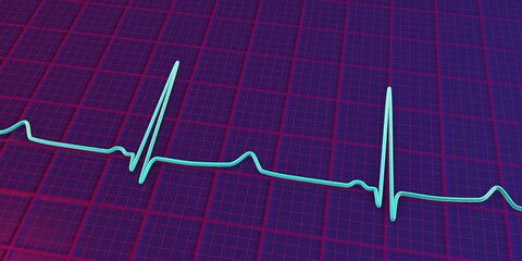 ECG of type 3 long QT syndrome, 3D illustration