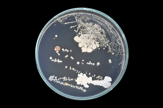 Bacterial load in food handlers. Bacteria in human hair. Bacteria in human beard. Personal hygiene test. Swab test in hair. Swab test in beard. Bacteria in hair. Bacteria in beard.
