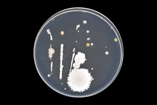 Bacterial load in food handlers. Bacteria in human hair. Bacteria in human beard. Personal hygiene test. Swab test in hair. Swab test in beard. Bacteria in hair. Bacteria in beard.