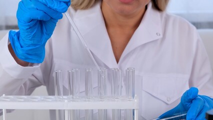 Close up research chemist takes samples for research and works in a laboratory with a micropipette...