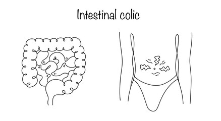 Intestinal colic
