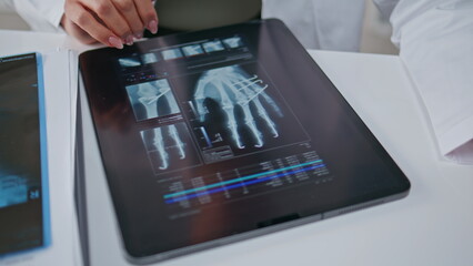 Radiologist reviewing hand x-ray images on digital tablet at clinic closeup