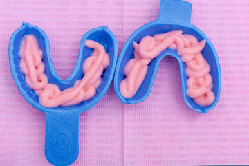 Top view of two blue fluoride gel foam trays filled with pink fluoride gel. These trays are used...