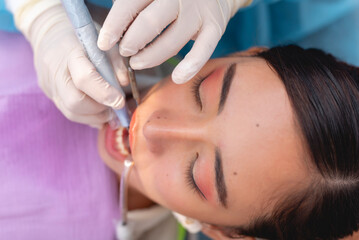 A female patient undergoing oral prophylaxis or dental cleaning procedure. A dental scaler is being used to remove plaque or tartar from the teeth, while a saliva ejector keeps the area dry.