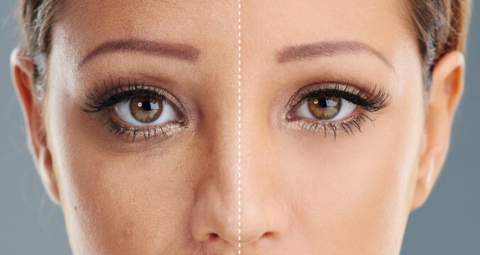 Comparison, portrait or eyes of woman in studio for beauty, makeup or skin treatment. Person, closeup or derma filler in face for anti aging, transformation or results on gray background for skincare