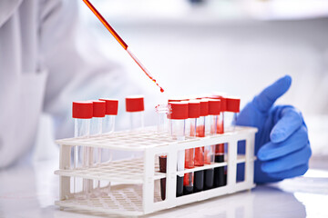 Blood study, hands and science in laboratory, research and studying monkeypox virus, infection and...