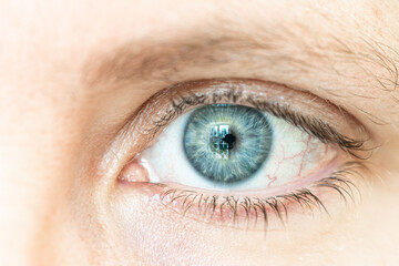 Fototapeta premium Closeup of a blue eye with red blood vessels