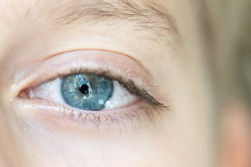 Obraz premium Closeup of a blue eye with red blood vessels
