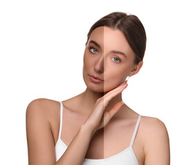 Collage with photos of beautiful young woman before and after solarium tanning on white background