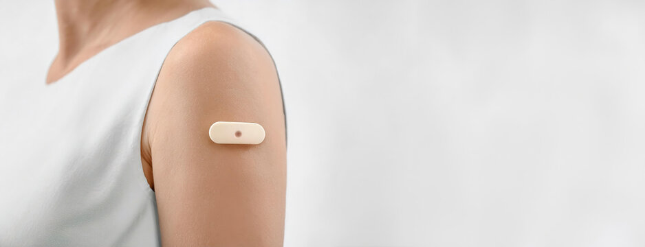 Person wearing a medical patch on arm for monitoring and treatment. Wearable device of real-time control of health through continuous glucose monitoring CGM system.