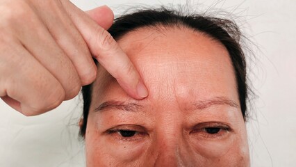 Obraz premium portrait the wrinkle and Flabby skin, forehead lines and Flabbiness, dark spots and blemish, scar and acne, swelling and ptosis, edema and loose on the face of middle aged women, health care concept.
