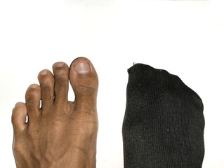 one foot wearing black socks and the other not wearing them. in the white background